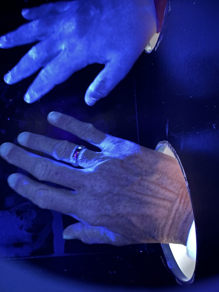 Zwei verschiedene Hände nach der Handdesinfektion.